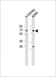 Anti-HHLA2 antibody used in Western Blot (WB). GTX05203