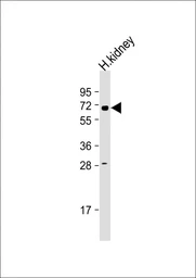 Anti-HHLA2 antibody used in Western Blot (WB). GTX05203