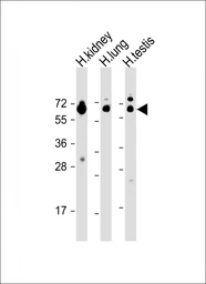 Anti-HHLA2 antibody used in Western Blot (WB). GTX05203