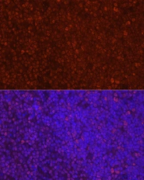 Anti-LEF1 antibody used in IHC (Paraffin sections) (IHC-P). GTX05206
