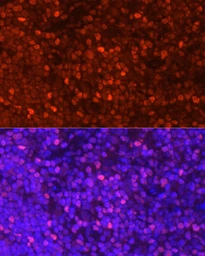 Anti-LEF1 antibody used in IHC (Paraffin sections) (IHC-P). GTX05206
