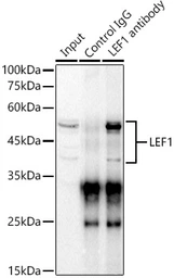 Anti-LEF1 antibody used in Immunoprecipitation (IP). GTX05206