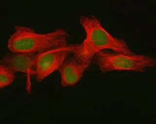 Anti-FBXO32 antibody used in Immunocytochemistry/ Immunofluorescence (ICC/IF). GTX05209