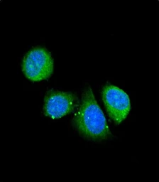 Anti-Asporin antibody used in Immunocytochemistry/ Immunofluorescence (ICC/IF). GTX05210