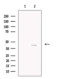Anti-Asporin antibody used in Western Blot (WB). GTX05211