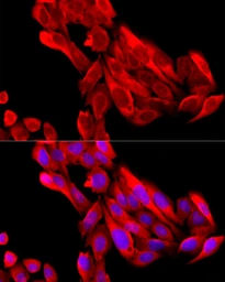 Anti-BNP / proBNP antibody used in Immunocytochemistry/ Immunofluorescence (ICC/IF). GTX05212