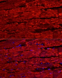 Anti-BNP / proBNP antibody used in IHC (Paraffin sections) (IHC-P). GTX05212