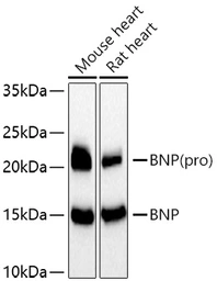 Anti-BNP / proBNP antibody used in Western Blot (WB). GTX05212