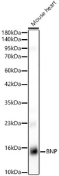 Anti-BNP antibody [ARC62057] used in Western Blot (WB). GTX05213