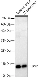 Anti-BNP antibody [ARC62057] used in Western Blot (WB). GTX05213