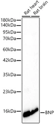 Anti-BNP antibody [ARC62057] used in Western Blot (WB). GTX05213