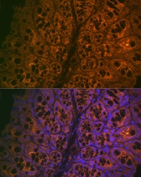Anti-CEACAM6 antibody [ARC2110] used in IHC (Paraffin sections) (IHC-P). GTX05214