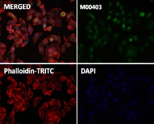Anti-NOX4 antibody [E-14] used in Immunocytochemistry/ Immunofluorescence (ICC/IF). GTX05217