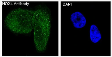 Anti-NOX4 antibody [E-14] used in Immunocytochemistry/ Immunofluorescence (ICC/IF). GTX05217