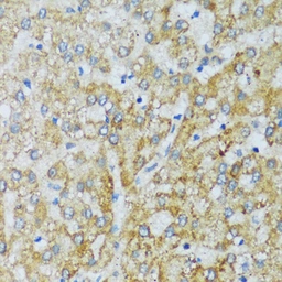Anti-C1qC antibody used in IHC (Paraffin sections) (IHC-P). GTX05218