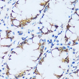 Anti-C1qC antibody used in IHC (Paraffin sections) (IHC-P). GTX05218