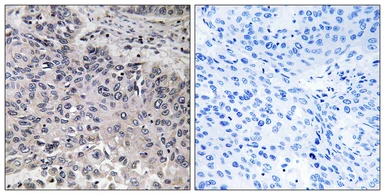 Anti-C1qC antibody used in IHC (Paraffin sections) (IHC-P). GTX05219