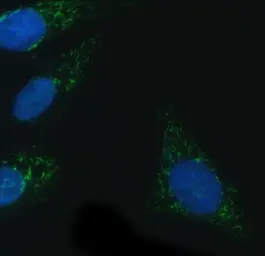 Anti-NOX4 antibody used in Immunocytochemistry/ Immunofluorescence (ICC/IF). GTX05223