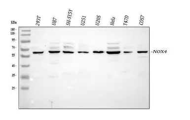 Anti-NOX4 antibody used in Western Blot (WB). GTX05223