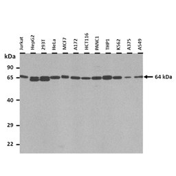 Anti-TRIM45 antibody used in Western Blot (WB). GTX05225