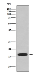Anti-CD59 antibody [AABE-3] used in Western Blot (WB). GTX05226