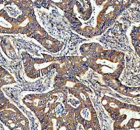 Anti-ADAM10 antibody [AAIC-1] used in IHC (Paraffin sections) (IHC-P). GTX05227