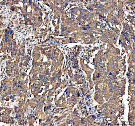 Anti-ADAM10 antibody [AAIC-1] used in IHC (Paraffin sections) (IHC-P). GTX05227