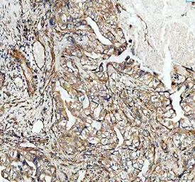 Anti-ADAM10 antibody [AAIC-1] used in IHC (Paraffin sections) (IHC-P). GTX05227