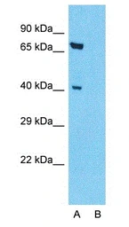 Anti-KLF2 antibody used in Western Blot (WB). GTX05228