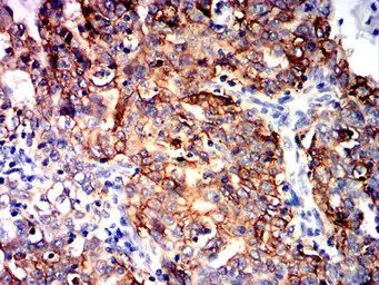 Anti-TACSTD2 antibody [6H10B11] used in IHC (Paraffin sections) (IHC-P). GTX05229