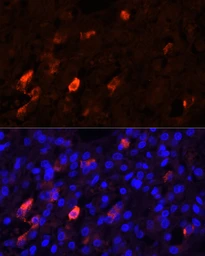 Anti-Proenkephalin antibody used in Immunocytochemistry/ Immunofluorescence (ICC/IF). GTX05231
