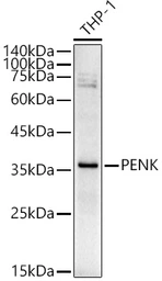 Anti-Proenkephalin antibody used in Western Blot (WB). GTX05231