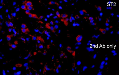 Anti-ST2 antibody used in IHC (Paraffin sections) (IHC-P). GTX05232