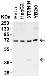 Anti-ST2 antibody used in Western Blot (WB). GTX05232