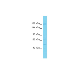 Anti-DDX60L antibody used in Western Blot (WB). GTX05234