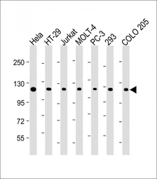 Anti-TERT antibody used in Western Blot (WB). GTX05257