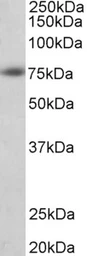 Anti-beta Amyloid (1-16) antibody used in Western Blot (WB). GTX05258