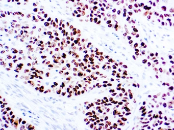 Anti-p40 antibody (ready-to-use) used in IHC (Paraffin sections) (IHC-P). GTX05260
