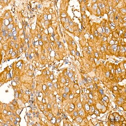 Anti-LAP3 antibody [ARC71182] used in IHC (Paraffin sections) (IHC-P). GTX05261