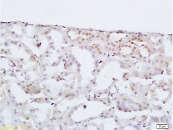 Anti-HOXA10 antibody used in IHC (Paraffin sections) (IHC-P). GTX05262
