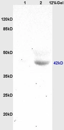 Anti-HOXA10 antibody used in Western Blot (WB). GTX05262