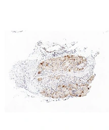 Anti-TRPA1 antibody used in IHC (Paraffin sections) (IHC-P). GTX05263