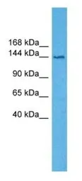 Anti-TRPA1 antibody used in Western Blot (WB). GTX05263