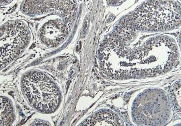 Anti-HOXA10 antibody used in IHC (Paraffin sections) (IHC-P). GTX05266