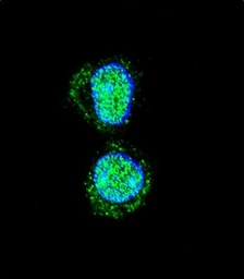 Anti-HOXA10 antibody used in Immunocytochemistry/ Immunofluorescence (ICC/IF). GTX05267