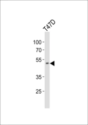 Anti-HOXA10 antibody used in Western Blot (WB). GTX05267