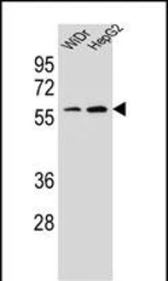 Anti-HOXA10 antibody used in Western Blot (WB). GTX05267
