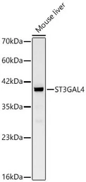 Anti-ST3GAL4 antibody used in Western Blot (WB). GTX05268