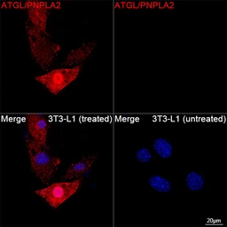 Anti-ATGL antibody [ARC80388] used in Immunocytochemistry/ Immunofluorescence (ICC/IF). GTX05269