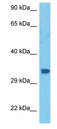 Anti-BARX2 antibody used in Western Blot (WB). GTX05270